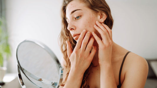 Person med aknebenägen hud som undersöker ansiktet i spegeln, exempel på hud som kräver rätt tryck vid användning av dermaroller.