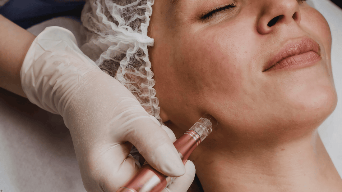 Microneedling-behandling på käklinje med dermapen, utförd av behandlare med handskar, som stimulerar kollagen och hudförnyelse under läkningsprocessen