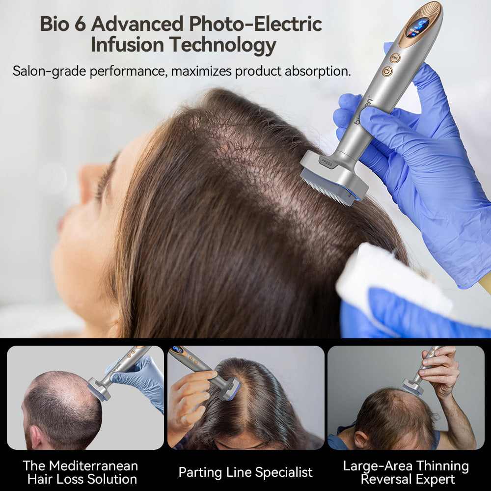 Bio Pen Bio 6 används vid behandling av håravfall med avancerad photo-electric infusion-teknologi, visar professionell applicering för att stimulera hårväxt och förbättra produktabsorption på tunnhåriga områden.